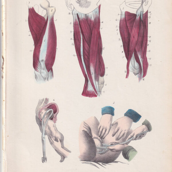 Tavola anatomica, muscoli, ginecologia, forcipe, 1839