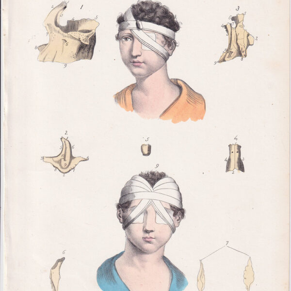 Tavola anatomica, oculistica, occhi, 1839