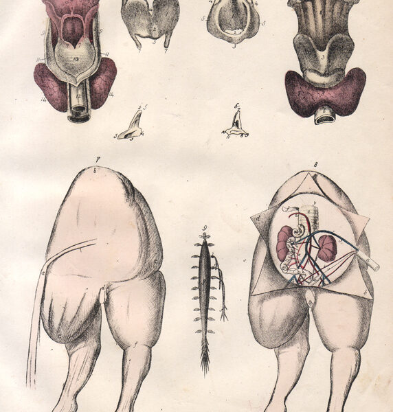 Tavola anatomica (malformazioni), 1839