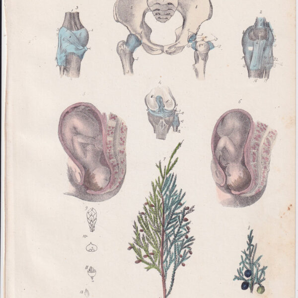 Tavola anatomica, ginecologia, 1839