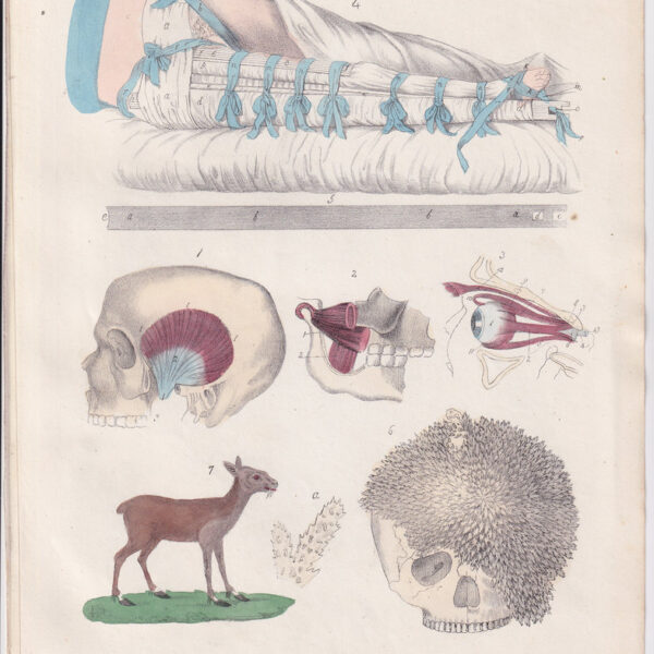 Tavola anatomica, cranio, ortopedia, 1839