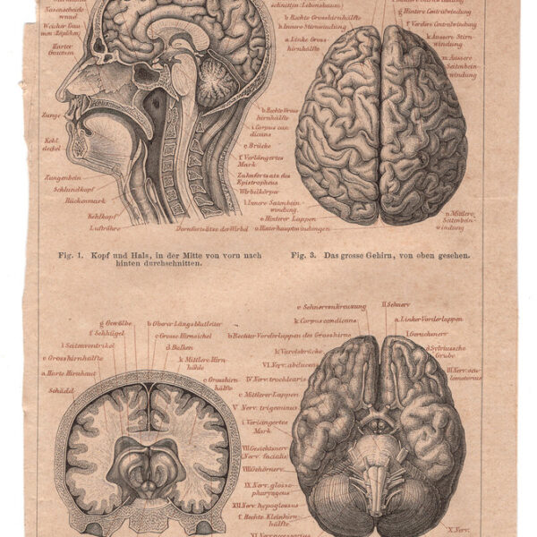 Cervello, Testa, 1890