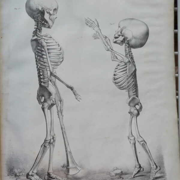 F.Bertinatti, Anatomia, Scheletro uomo e bambino, 1839