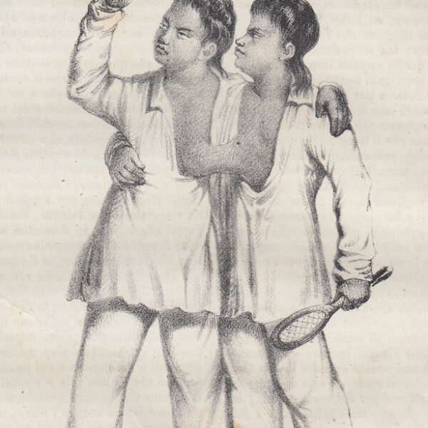 Eng e Chang gemelli siamesi, 1841