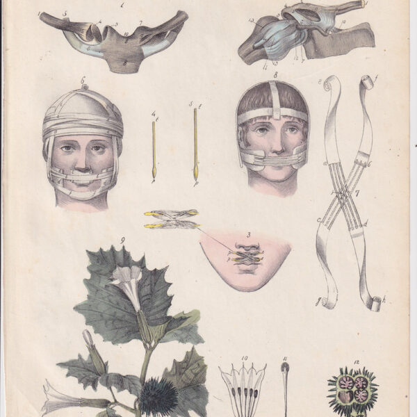Tavola anatomica, chirurgia, 1839